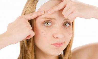What Causes Acne